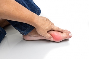 Gout&#039;s Impact on Foot Health