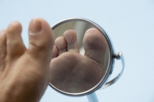 Treatment of Chronic Wounds on the Feet