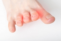 Can Morton's Neuroma Go Away?